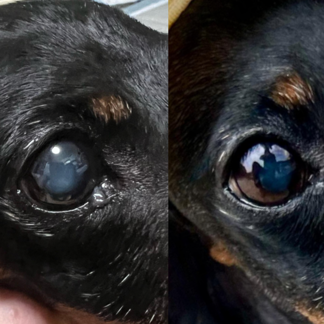 Aging Lens