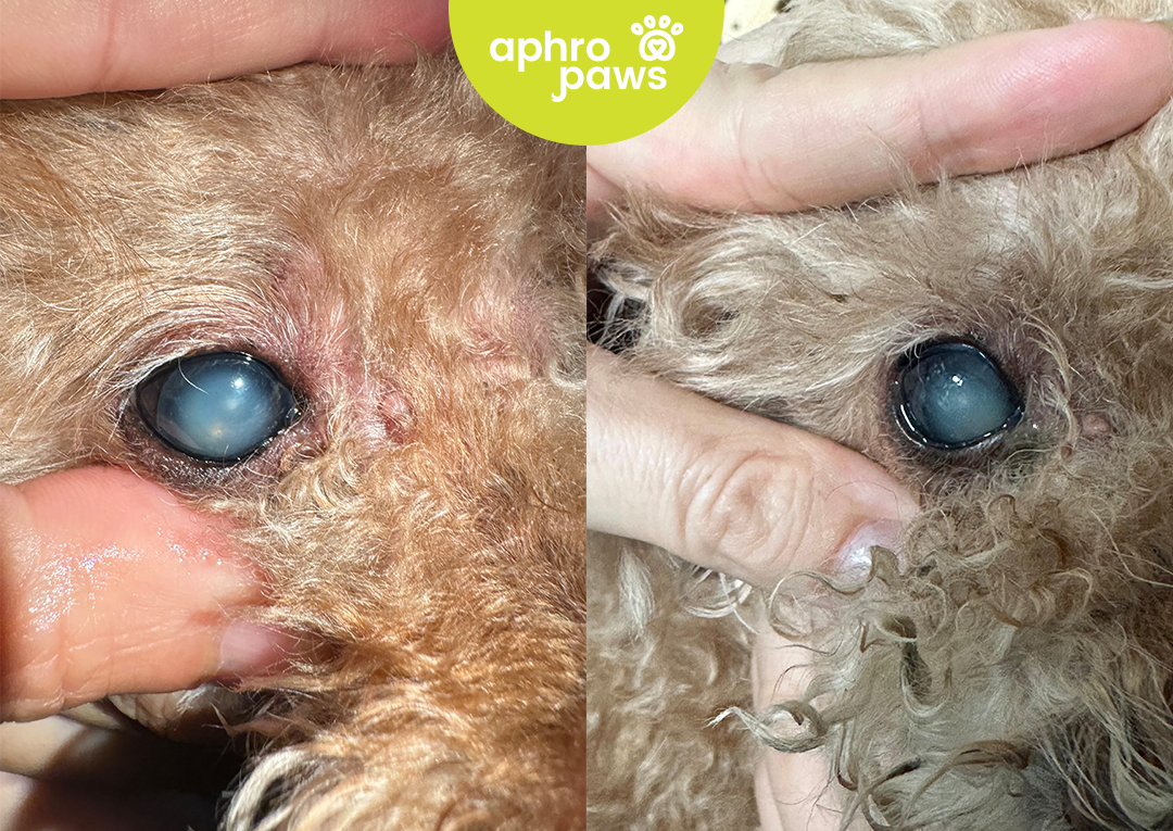 Mature Cataracts