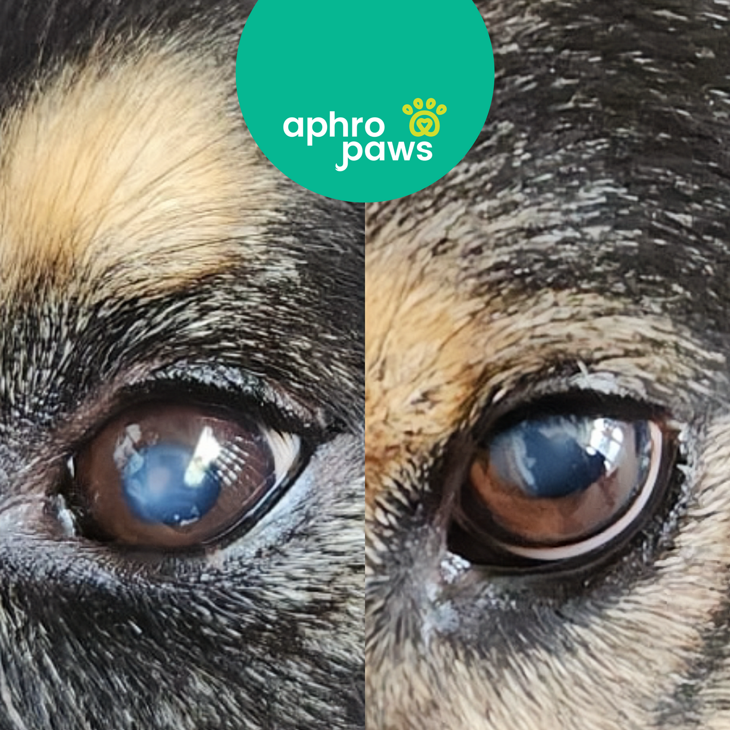 Immature Cataracts